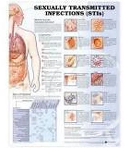 Chart, Aids – Polylab