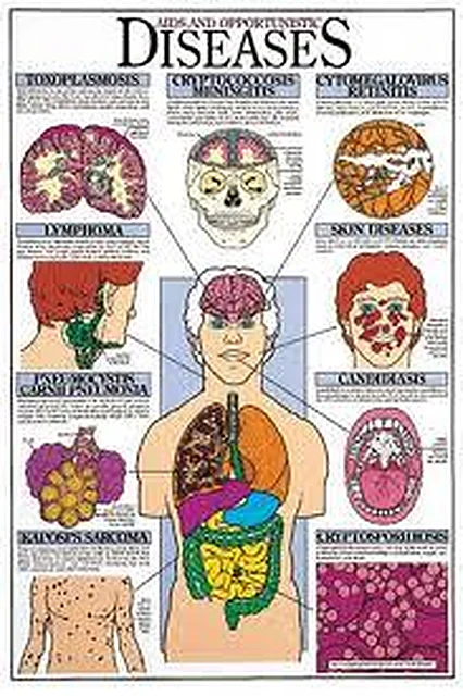 Diseases Chart – Polylab